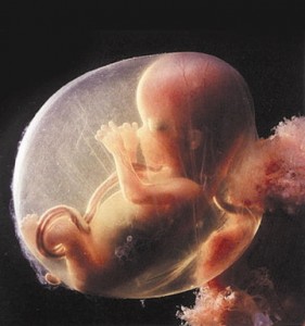 Abortus Abortus