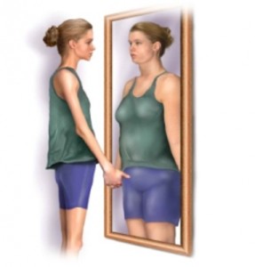 Anorexia nervosa 2