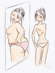 Anorexia nervosa