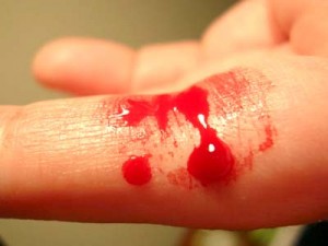 Bloedingen Bloedingen