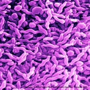 Enteritis