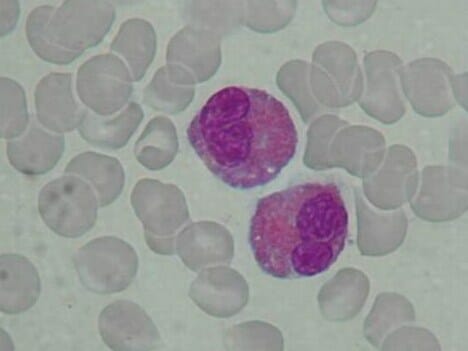 Eosinofielen