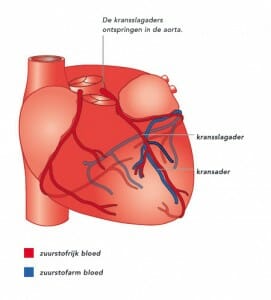 Tekening van het hart met de kransslagaders, met labels voor de kransslagader en de kransader en een legenda voor zuurstofrijk en zuurstofarm bloed