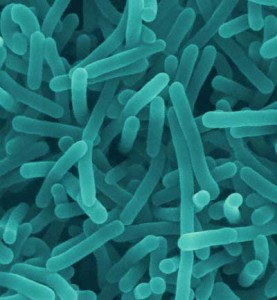 Listeriosis Listeriosis