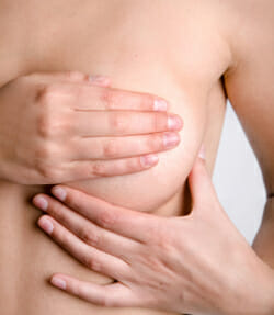 Mastitis Mastitis