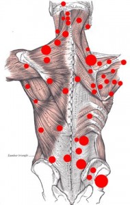 Musculatuur