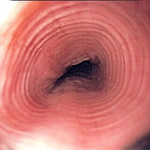 Oesophagus