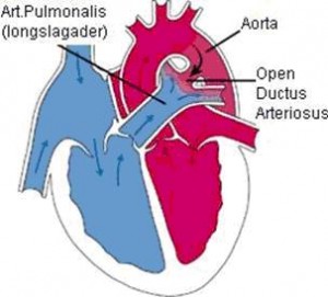 Open ductus Botalli
