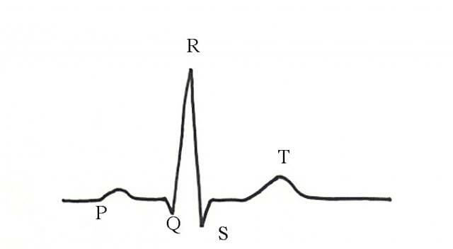 pqrst complex lichaams elektriciteit menselijk lichaam pqrst