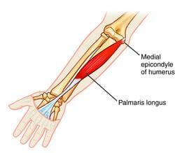 Palmaris longus