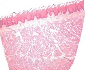 Papillae filiformes