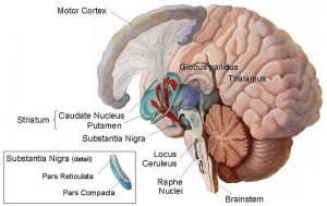Parkinson