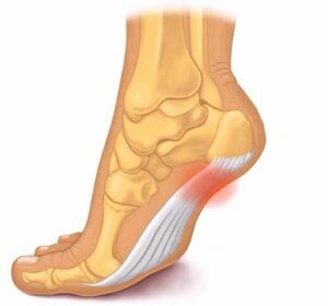 Plantaris