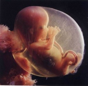 Prenatale zorg