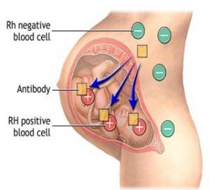 Rhesusfactor