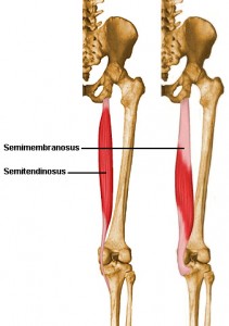 Semimembranosus