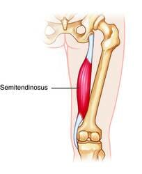 Semitendinosus