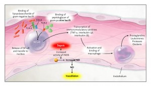 Sepsis