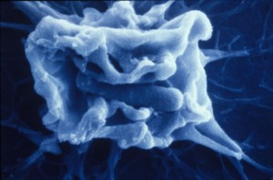 Shigellose.