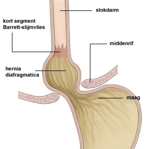 slokdarm slokdarm