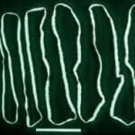 Spoelwormbesmetting