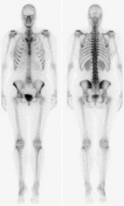 botscan