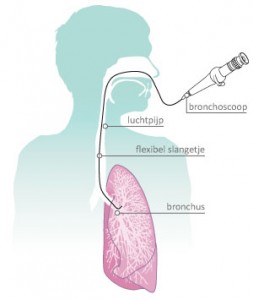 bronchoscopie bronchoscopie