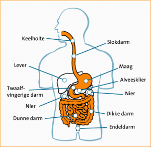 colitis ulcerosa