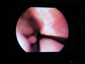 endoscopie