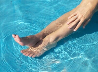 flebitis