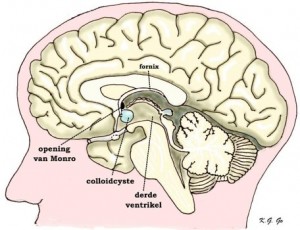 hypofysetumoren hypofysetumoren