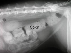 megacolon