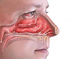 membranen