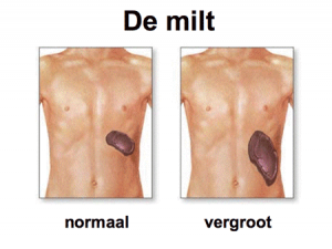 miltvergroting