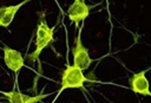 neuroblastoom