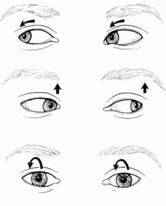 nystagmus nystagmus