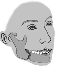 onderkaak
