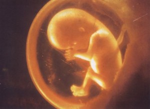 prenatale diagnostiek