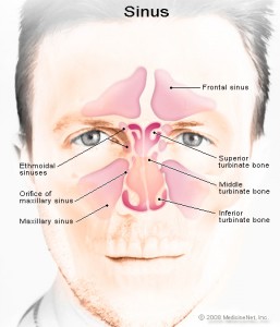rhinitis rhinitis