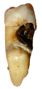 tandbederf