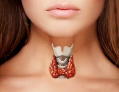 traag werkende schildklier