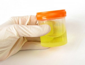 urine urine