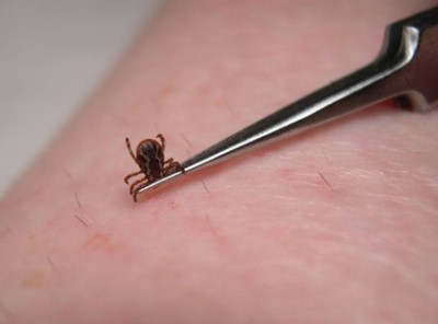 ziekte van Lyme